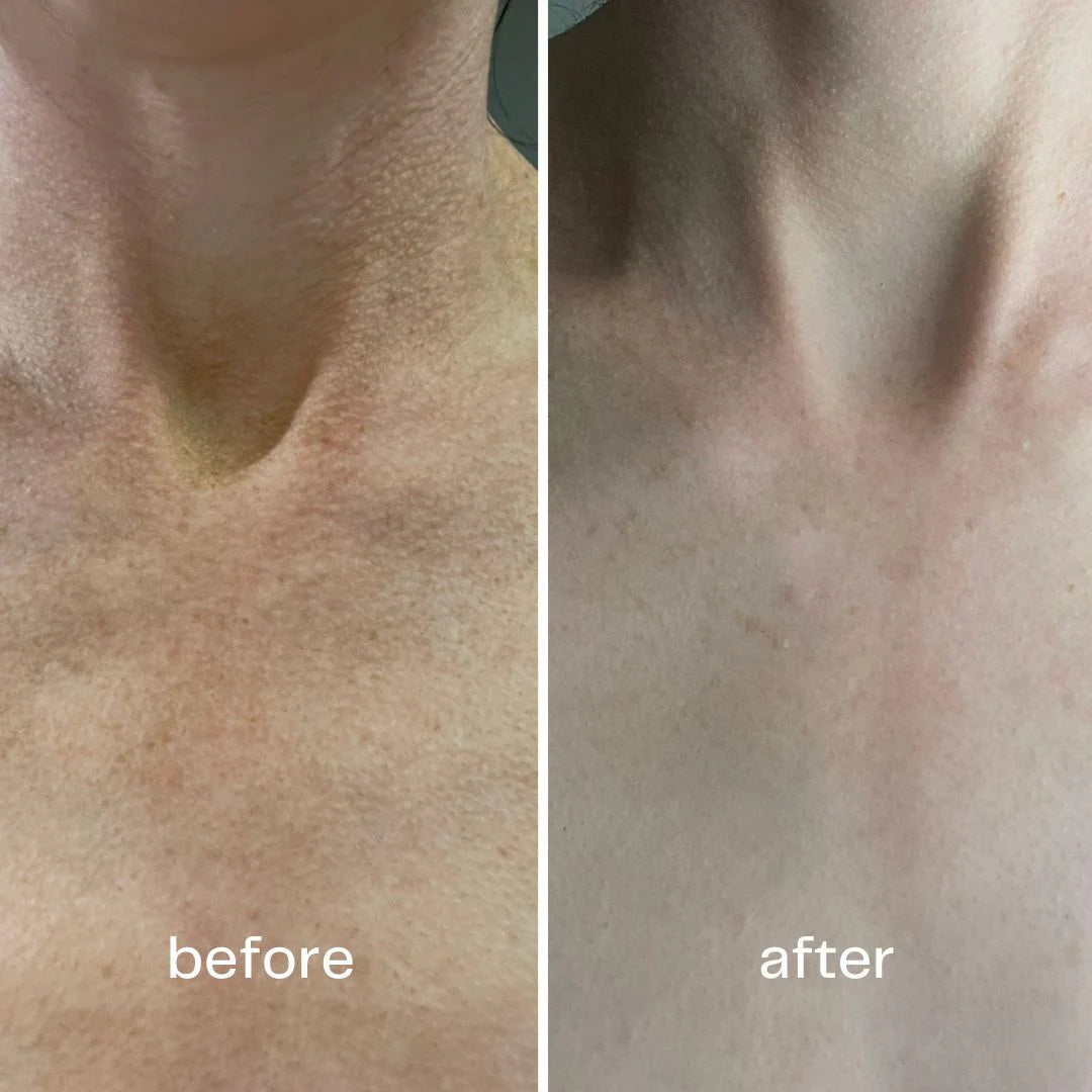 1 Original Ecrin Hair Removal Spray + 1 Exfoliating Glove