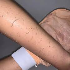 HERJOYFUL™- Skin Exfoliating Glove