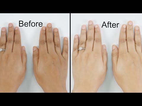 EpiGlow Medicated Hand & Feet Whitening Cream + Skin Exfoliating Glove Duo