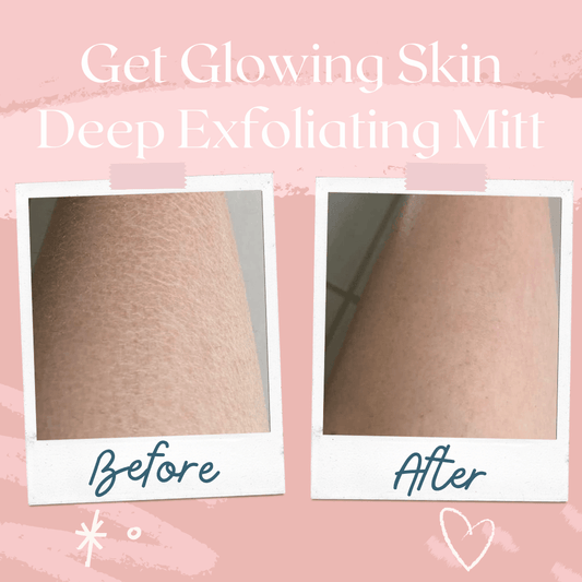 HERJOYFUL™- Skin Exfoliating Glove