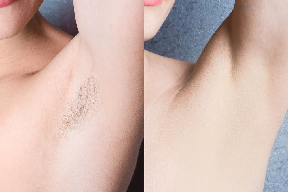 1 Hair Removing Machine + 1 Exfoliating Glove