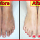 EpiGlow Medicated Hand & Feet Whitening Cream + Skin Exfoliating Glove Duo