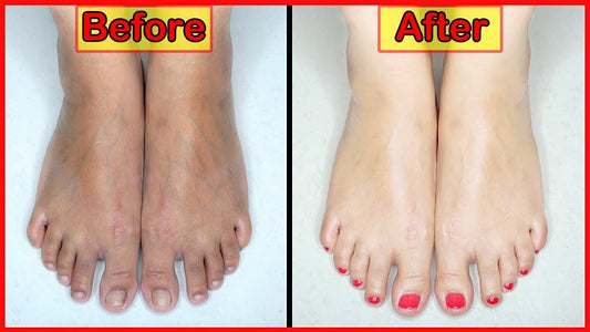 EpiGlow – Medicated Hand & Feet Whitening Cream